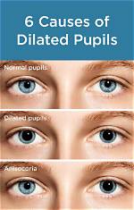 7 Reasons Why Your Pupils May Be Dilated, from Low Light to Sexual Attraction