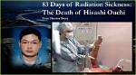 Declassified Horror: Hisashi Ouchi's Tragic Last Moments