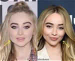 Did Sabrina Carpenter Get Lip Injections? Exploring the Rumors