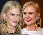 Dr Nicole Kidman's Facelift - Did She Get It?