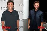 Has Jonathan Cheban Had Plastic Surgery?