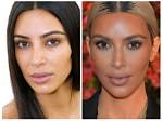 Kim Hieora | Done Plastic Surgery? Before and After Photo