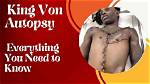 King Von's Autopsy: Unraveling the Mystery Behind His Tragic Death