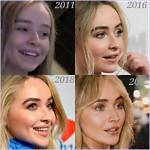 The Ultimate Guide: Did Sabrina Carpenter Undergo Cosmetic Surgery?