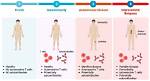 The Ultimate Guide to Radamm: Understanding and Treating This Autoimmune Disease